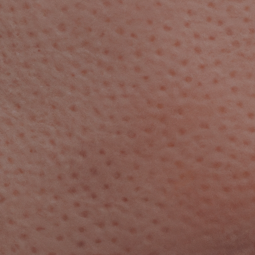 Light Red/Pink Dots or Bumps on the Skin Causes